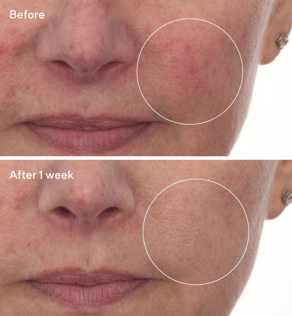 Cellular Hydration Barrier Repair Serum Refill - Image 4