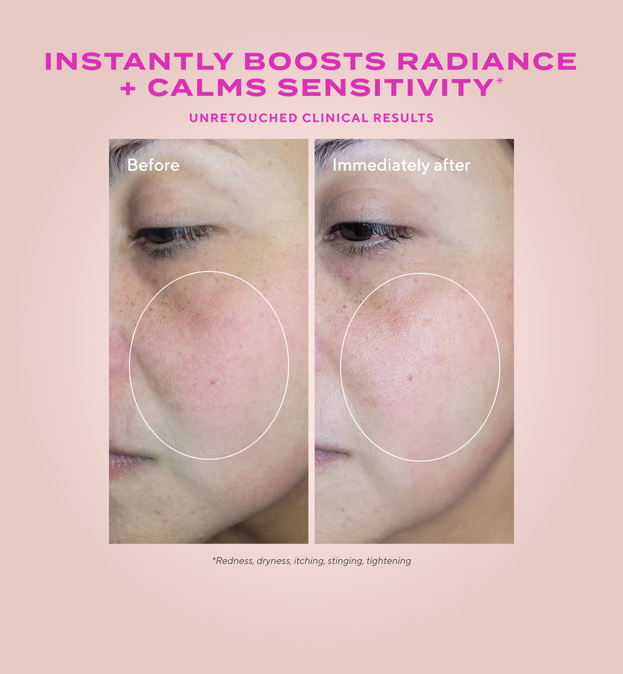 Gentle Glycolic Acid Resurfacing Serum for Sensitive Skin - Image 3