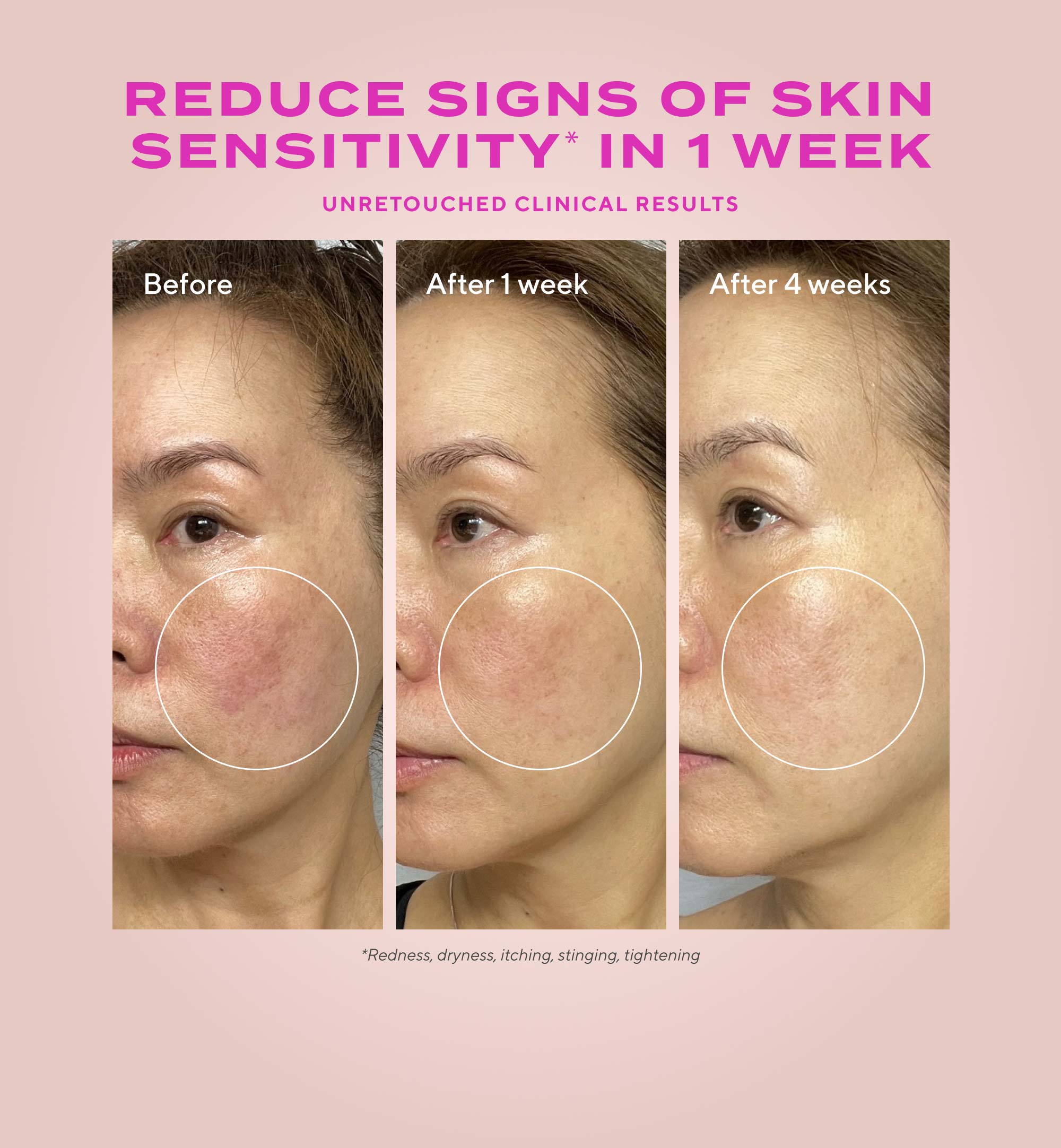 Gentle Glycolic Acid Resurfacing Serum for Sensitive Skin Refill - Image 4