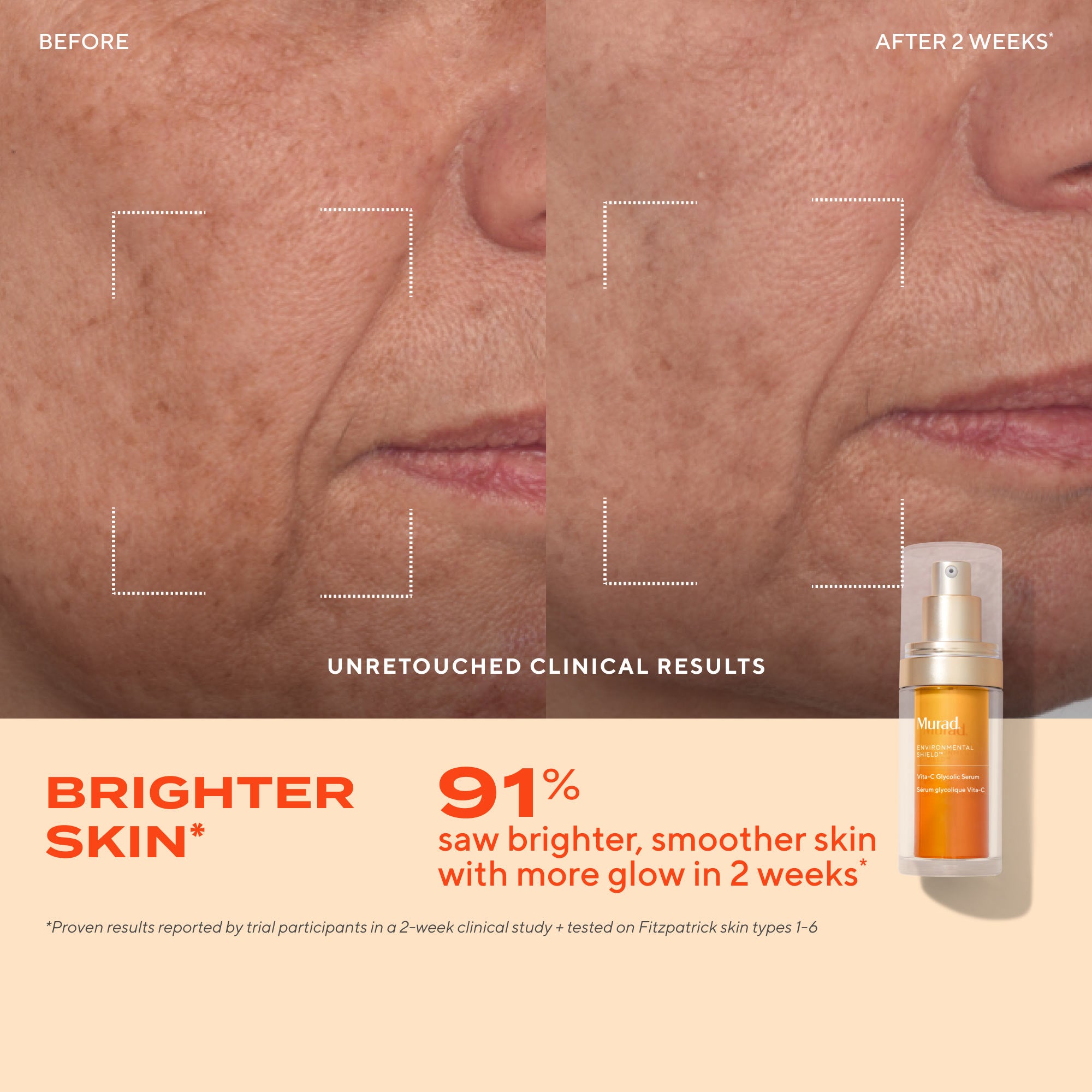 Glow Better Brightening Discovery Kit - Image 7