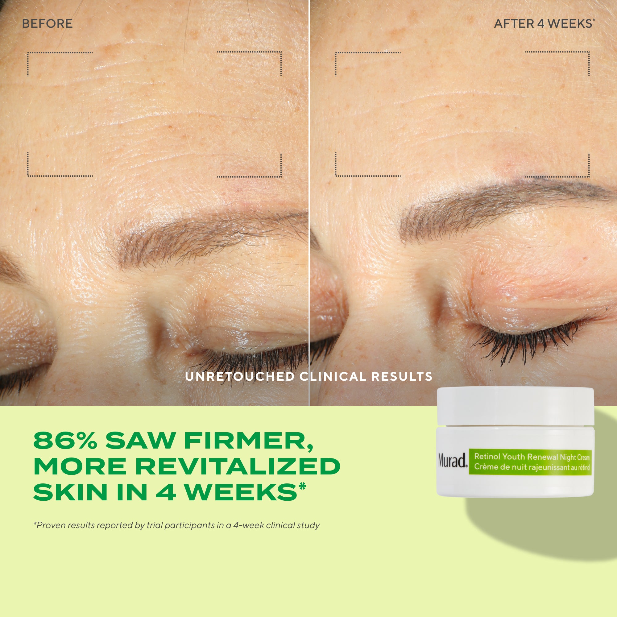 3-Piece Retinol Revival Regimen - Image 3