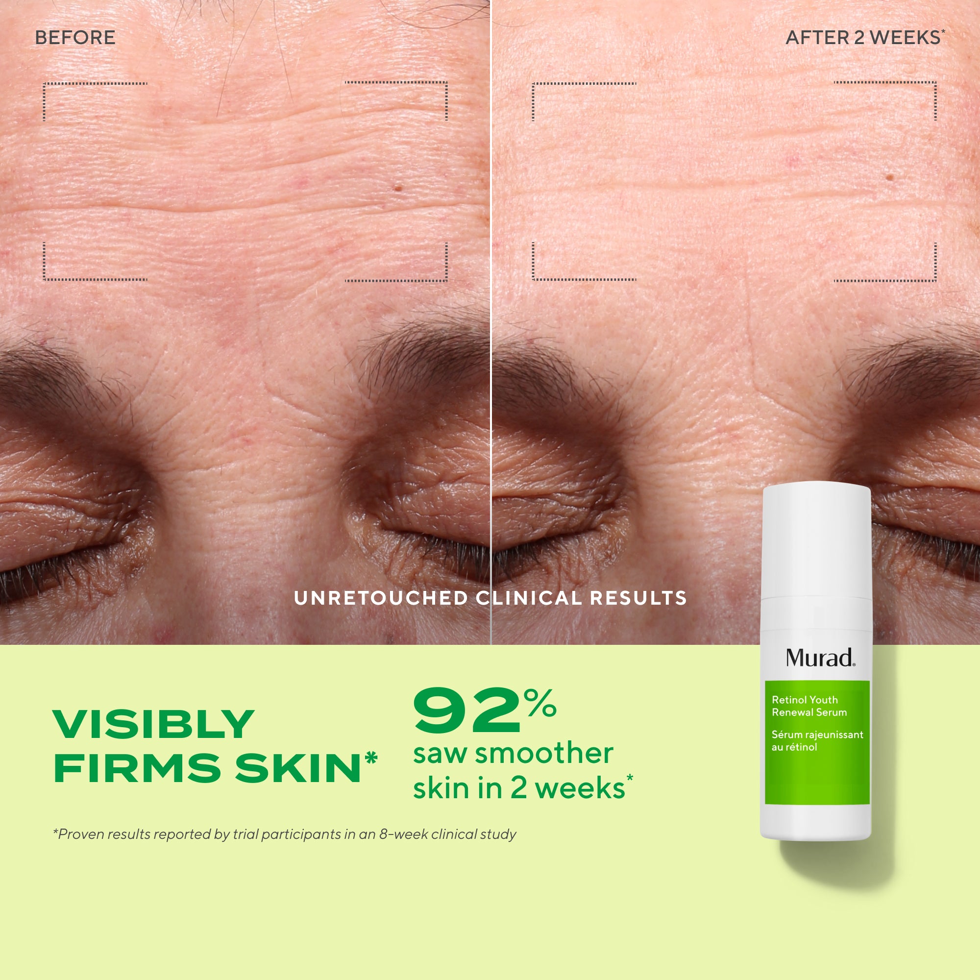 3-Piece Retinol Revival Regimen - Image 2