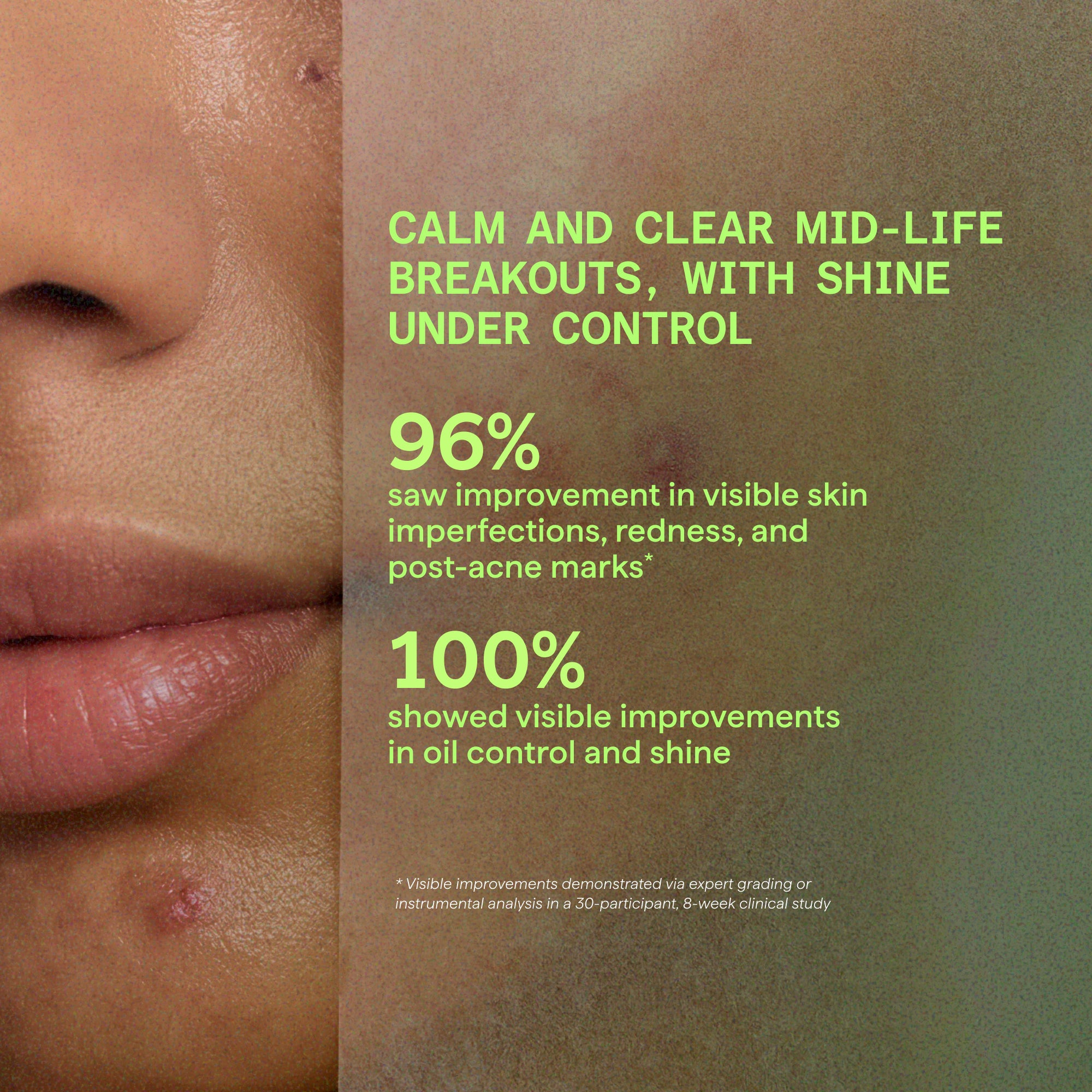 Biome-Balancing Calm & Recover Cream - Image 2