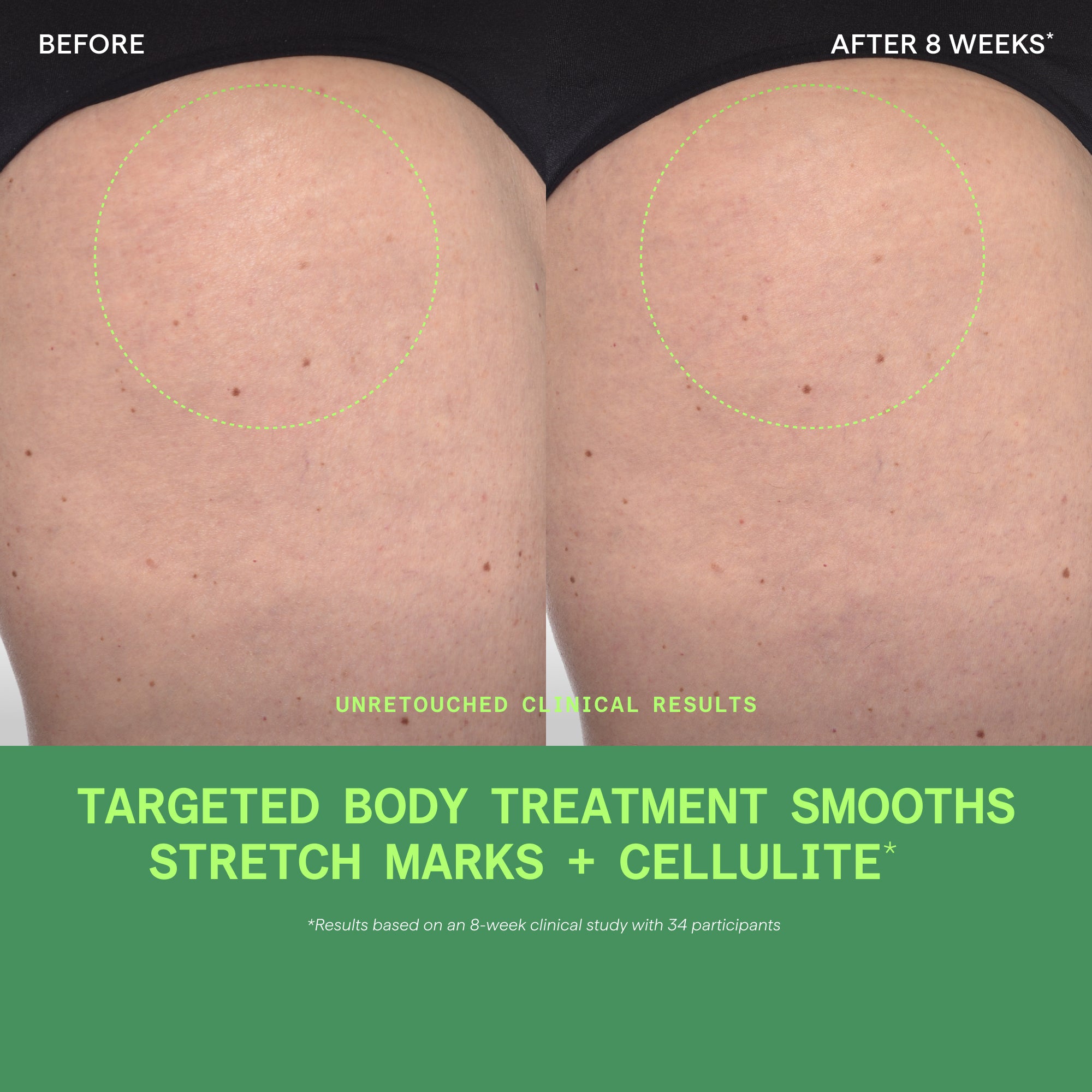 Retinal ReSculpt Body Treatment - Image 7